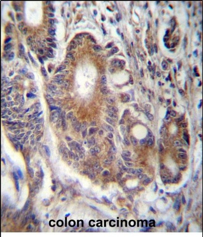 RAB21 Antibody in Immunohistochemistry (Paraffin) (IHC (P))