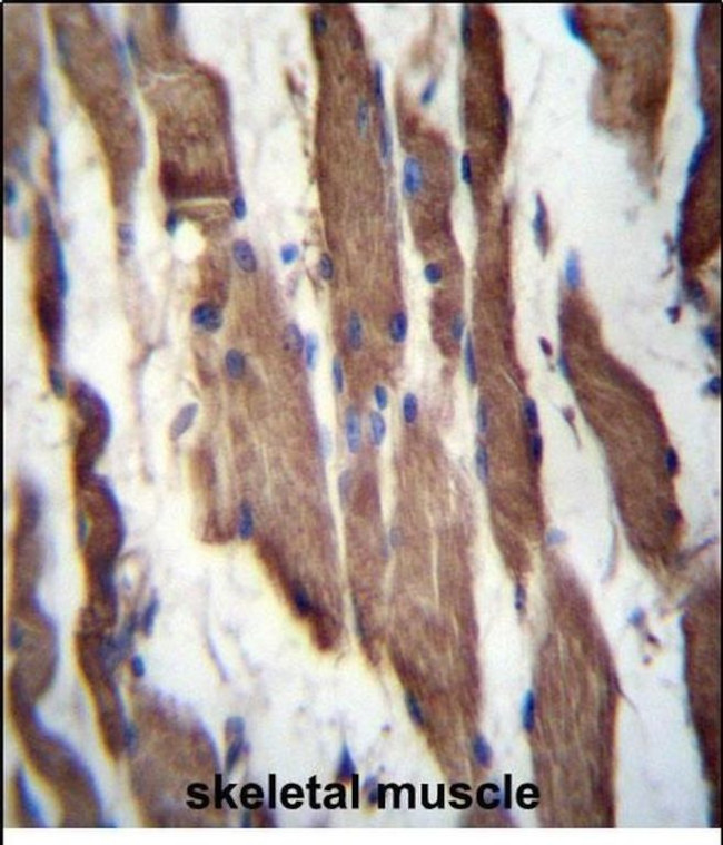 TGFBRAP1 Antibody in Immunohistochemistry (Paraffin) (IHC (P))