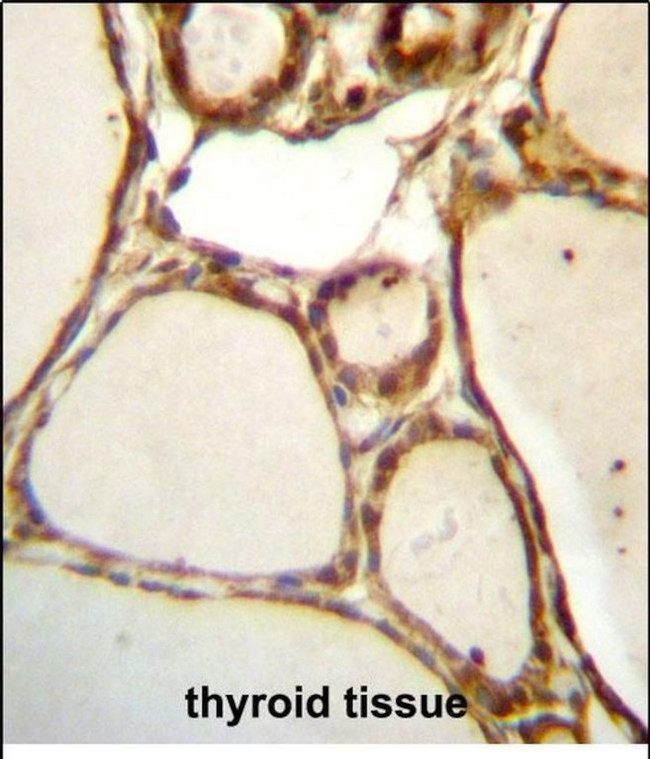 HJURP Antibody in Immunohistochemistry (Paraffin) (IHC (P))