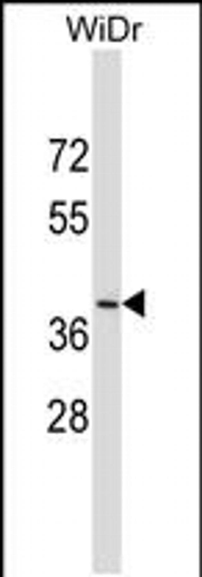 DUOXA2 Antibody in Western Blot (WB)