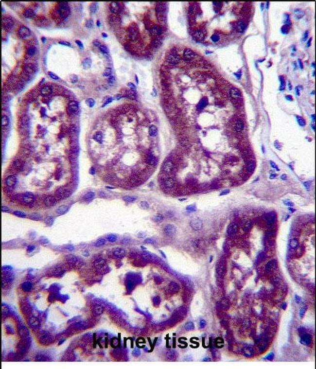 DPYS Antibody in Immunohistochemistry (Paraffin) (IHC (P))