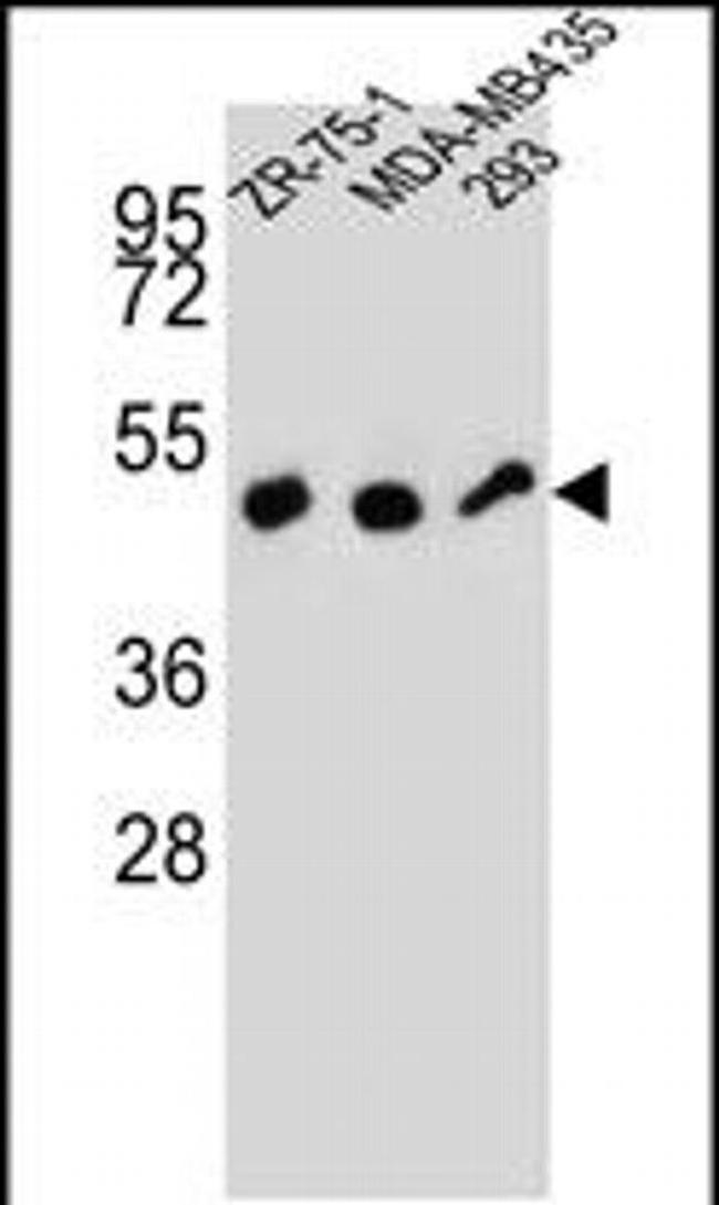 ZFP30 Antibody in Western Blot (WB)