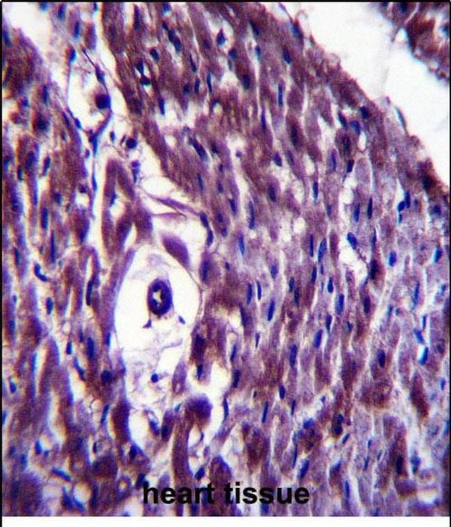 MAGED4 Antibody in Immunohistochemistry (Paraffin) (IHC (P))