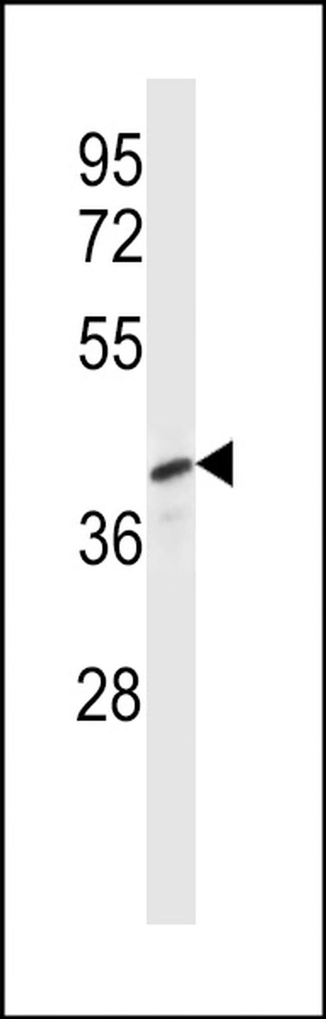 Pellino 3 Antibody in Western Blot (WB)