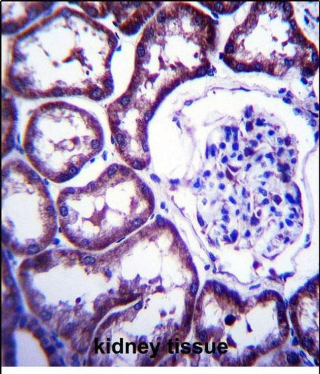 TXNDC15 Antibody in Immunohistochemistry (Paraffin) (IHC (P))