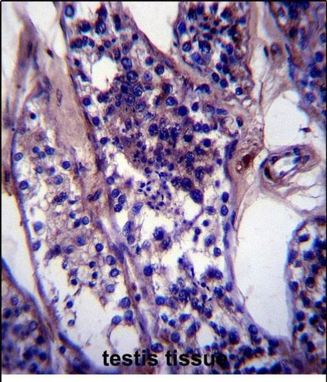 SPDL1 Antibody in Immunohistochemistry (Paraffin) (IHC (P))