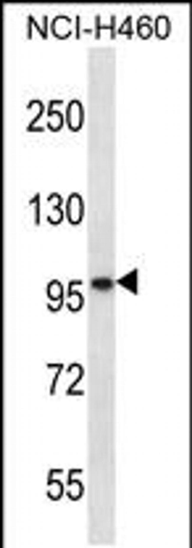 SLC6A17 Antibody in Western Blot (WB)