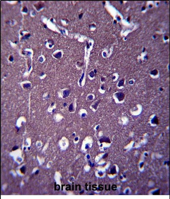 ZSWIM5 Antibody in Immunohistochemistry (Paraffin) (IHC (P))