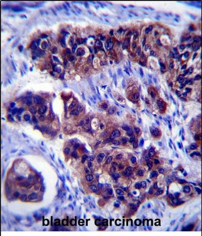 ZDHHC24 Antibody in Immunohistochemistry (Paraffin) (IHC (P))