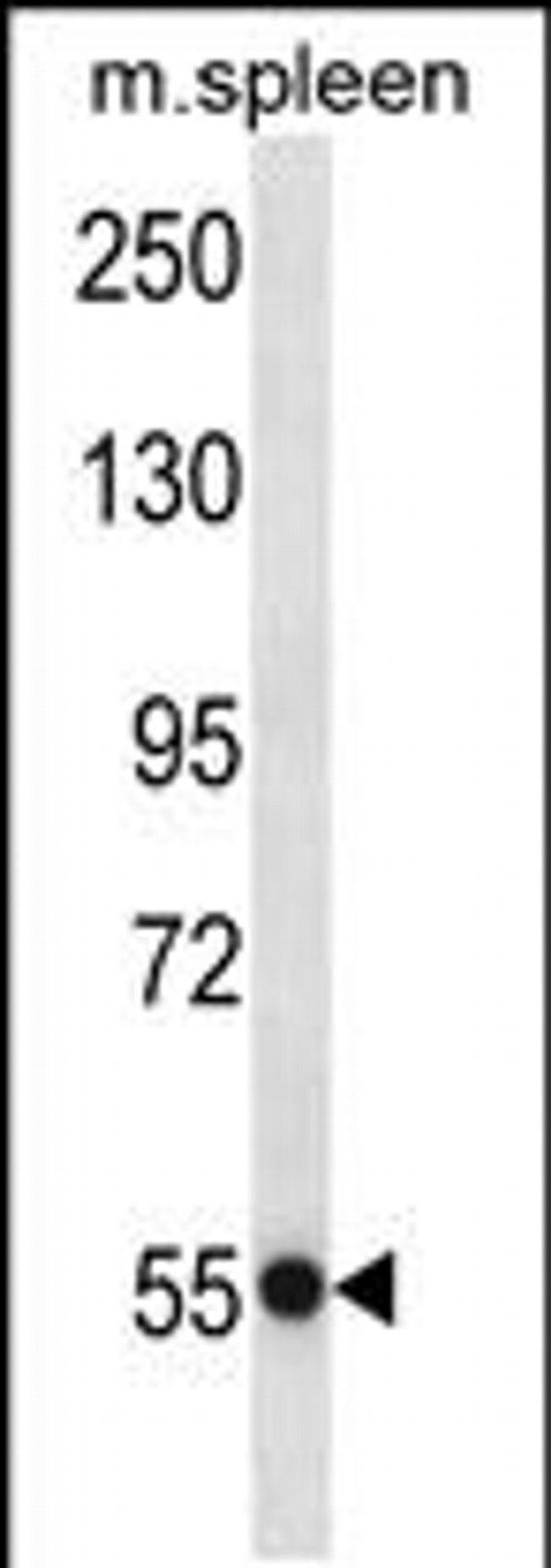 USP40 Antibody in Western Blot (WB)