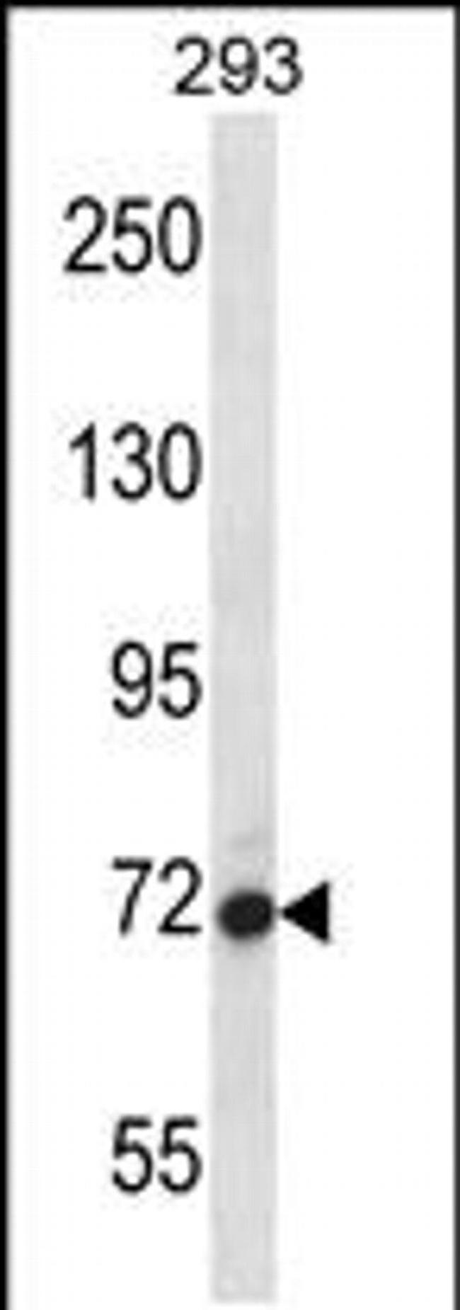 AGAP4 Antibody in Western Blot (WB)