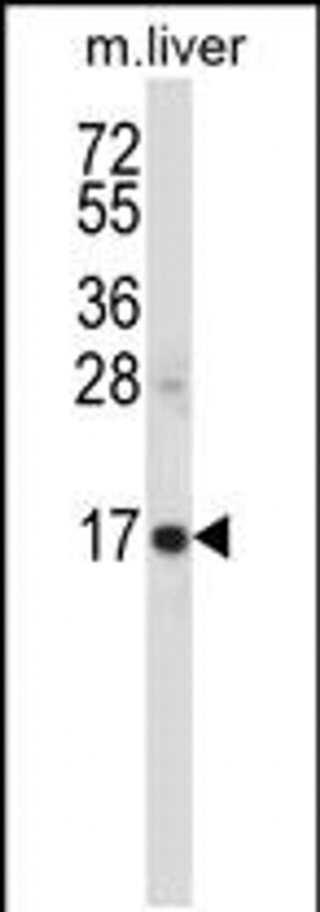 SSSCA1 Antibody in Western Blot (WB)
