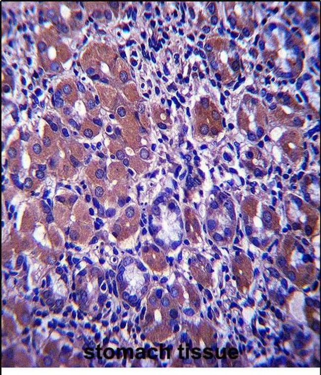 B4GALNT3 Antibody in Immunohistochemistry (Paraffin) (IHC (P))