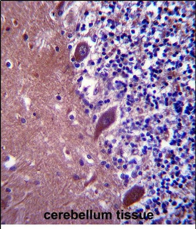 TTC13 Antibody in Immunohistochemistry (Paraffin) (IHC (P))