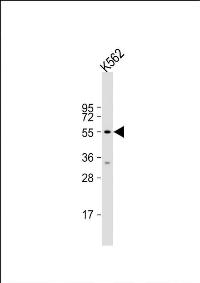 HYAL4 Antibody in Western Blot (WB)