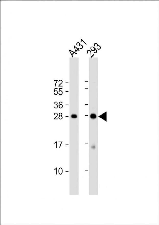 H1FX Antibody in Western Blot (WB)