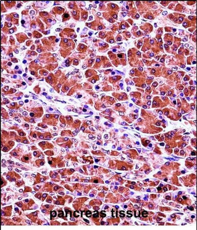 CELA3B Antibody in Immunohistochemistry (Paraffin) (IHC (P))