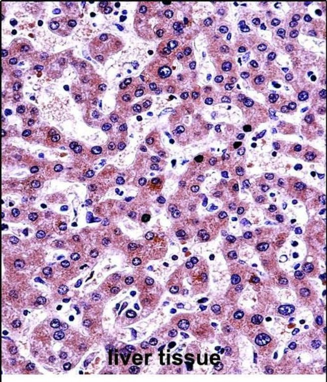 NNMT Antibody in Immunohistochemistry (Paraffin) (IHC (P))