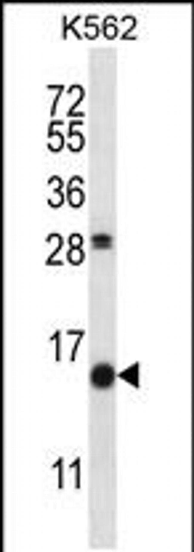 SCGB1D2 Antibody in Western Blot (WB)