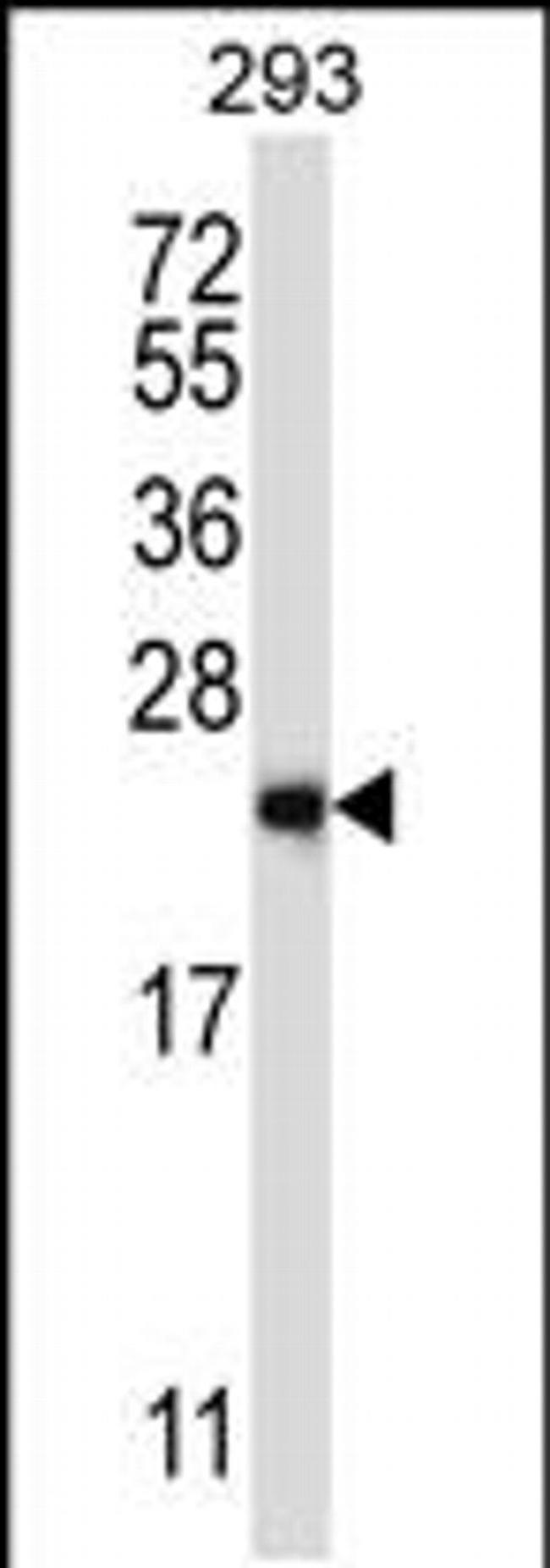RAB1B Antibody in Western Blot (WB)