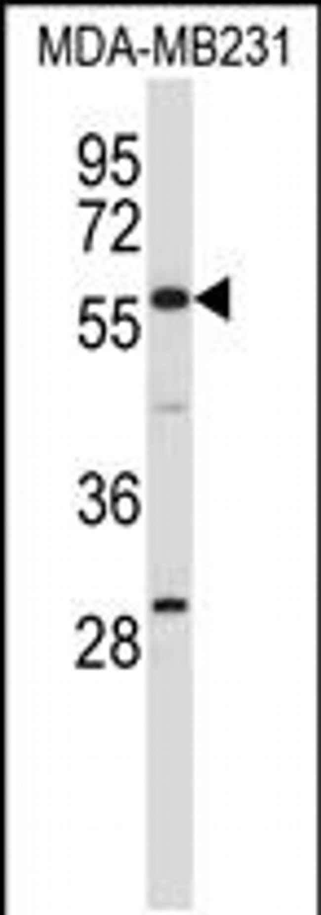 EHD1 Antibody in Western Blot (WB)