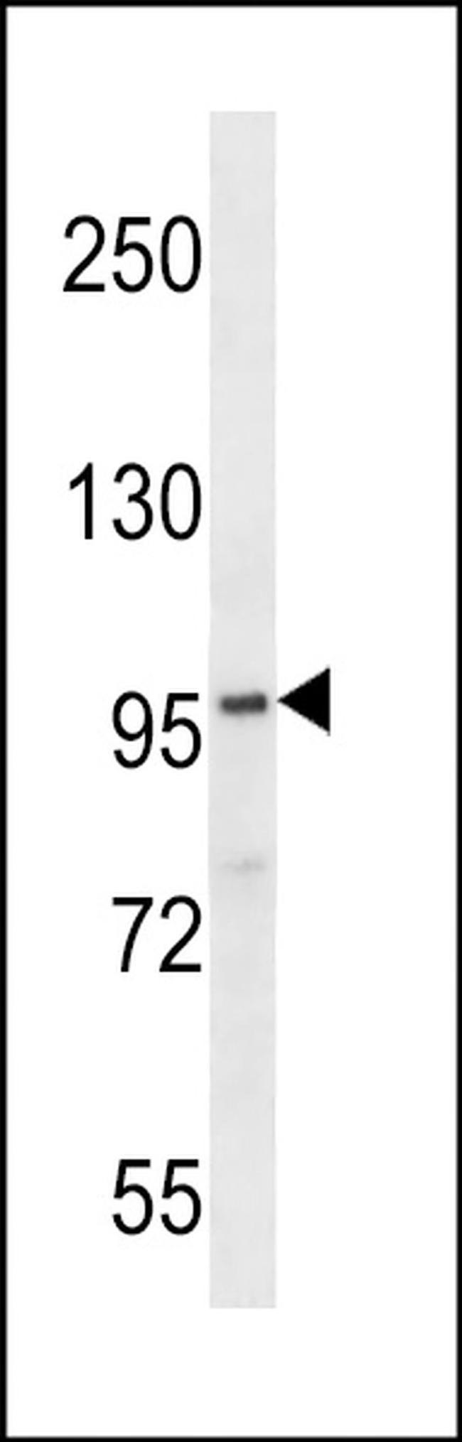 FAM83G Antibody in Western Blot (WB)