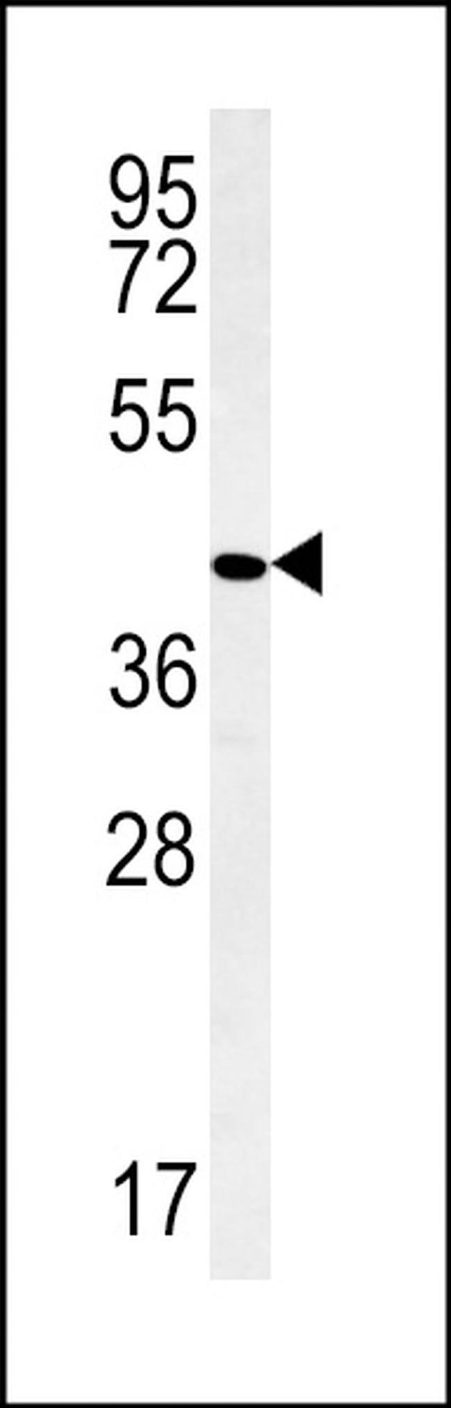PPAN Antibody in Western Blot (WB)