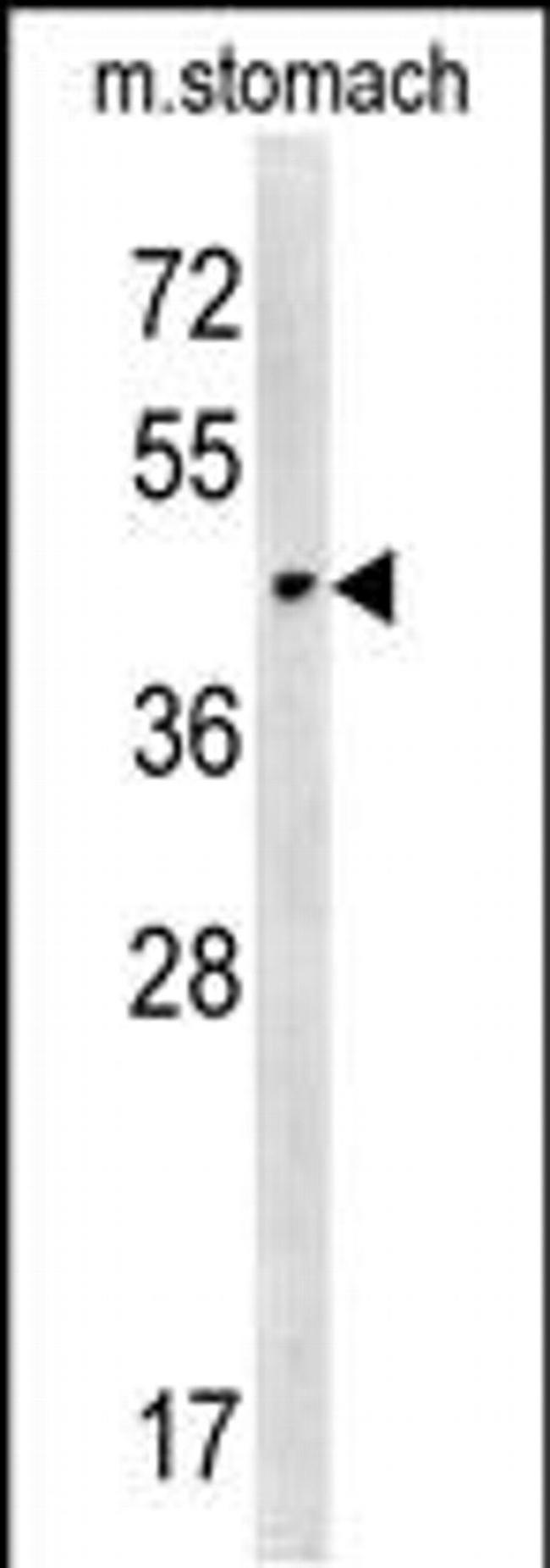 CHST14 Antibody in Western Blot (WB)