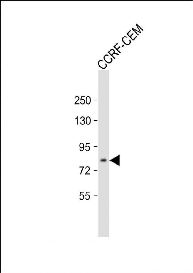 ADAM11 Antibody in Western Blot (WB)