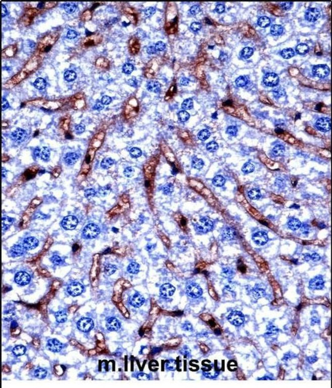 DYRK2 Antibody in Immunohistochemistry (Paraffin) (IHC (P))