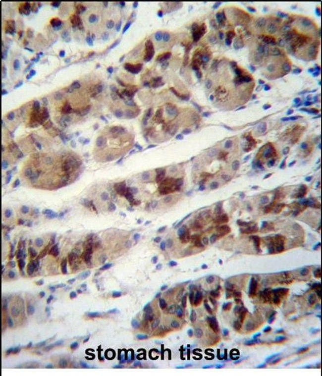 DDA1 Antibody in Immunohistochemistry (Paraffin) (IHC (P))