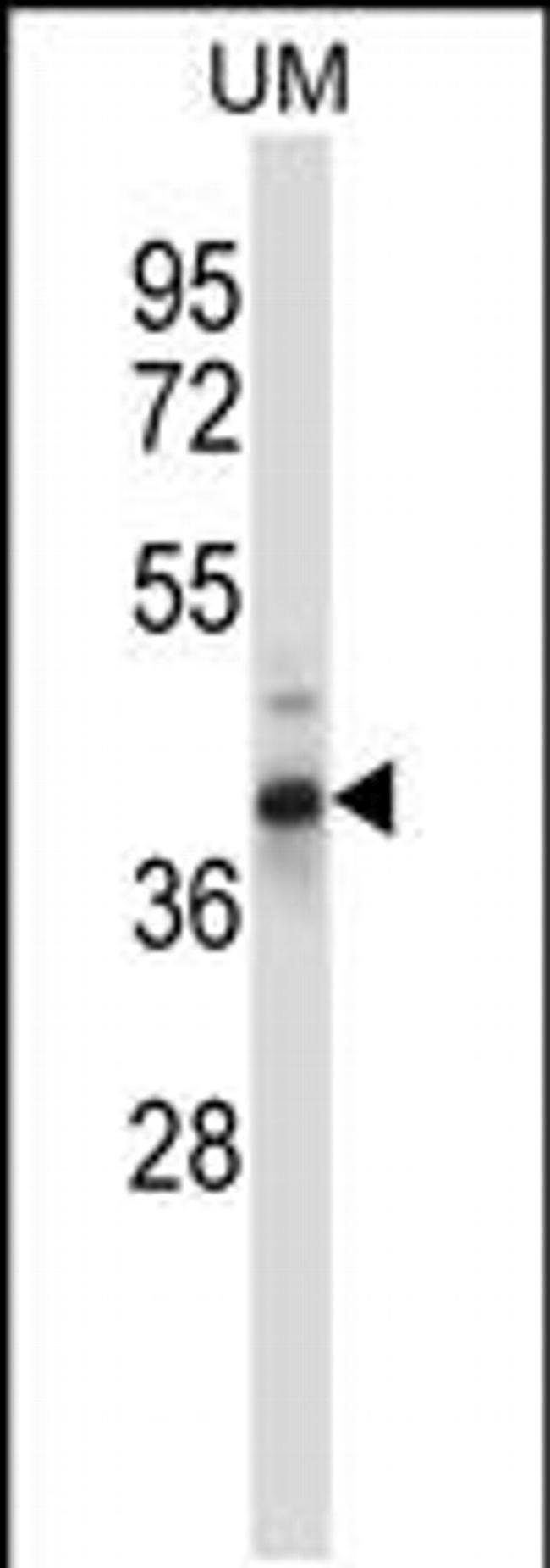 OAF Antibody in Western Blot (WB)