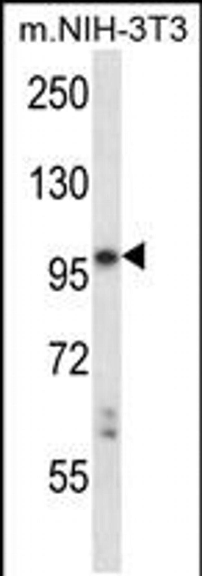 LTK Antibody in Western Blot (WB)