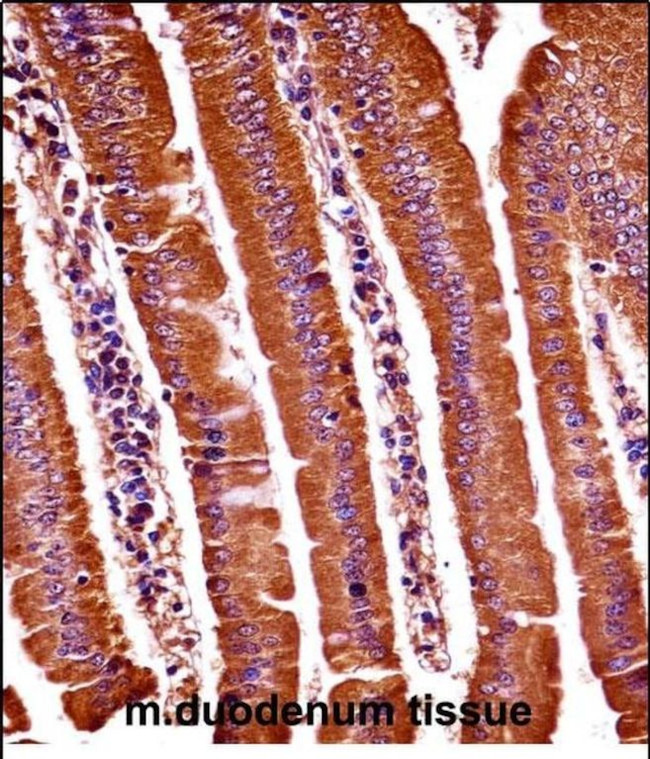 OXSR1 Antibody in Immunohistochemistry (Paraffin) (IHC (P))