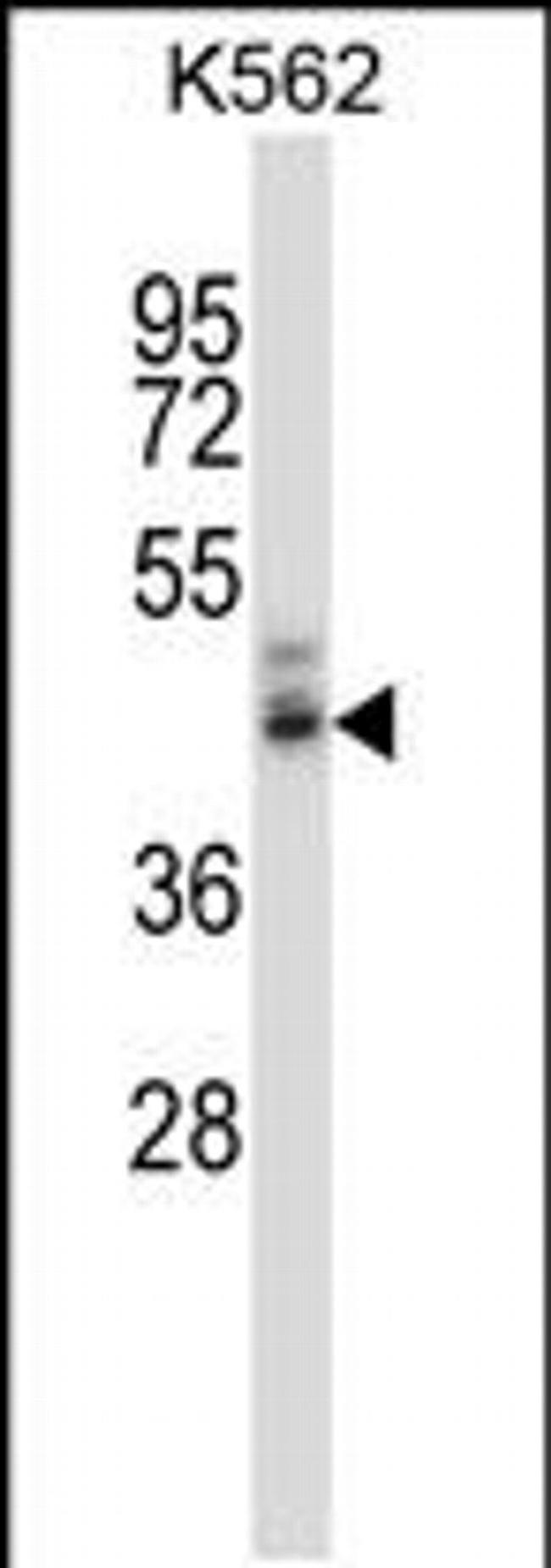 NPY4R Antibody in Western Blot (WB)