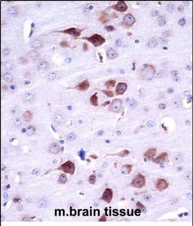 MATK Antibody in Immunohistochemistry (Paraffin) (IHC (P))
