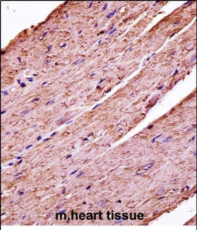 PDK3 Antibody in Immunohistochemistry (Paraffin) (IHC (P))