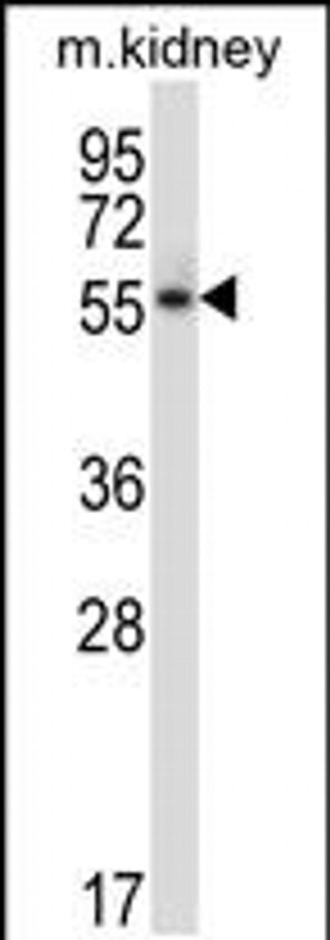 PLK5 Antibody in Western Blot (WB)