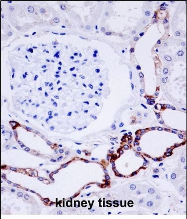 OTUD7B Antibody in Immunohistochemistry (Paraffin) (IHC (P))