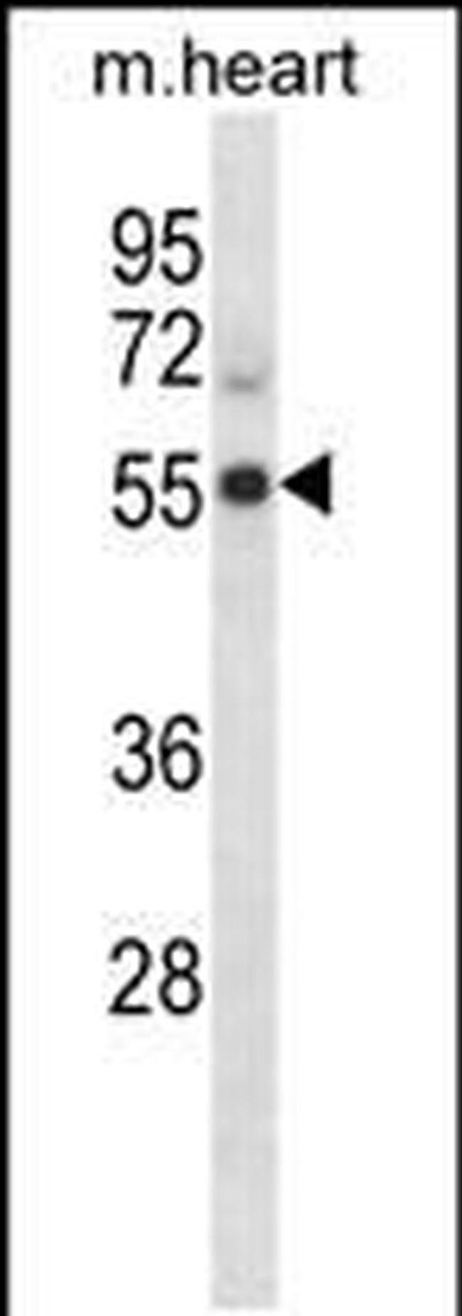PFTK2 Antibody in Western Blot (WB)