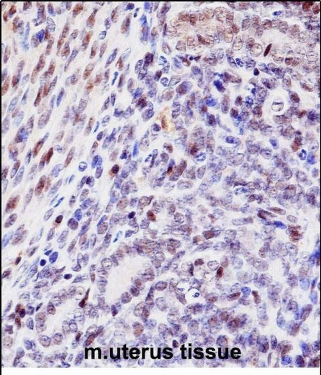 HOXD10 Antibody in Immunohistochemistry (Paraffin) (IHC (P))