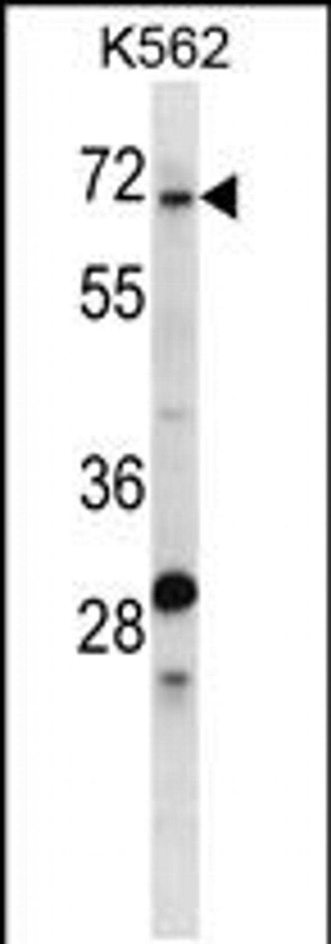 TRIP10 Antibody in Western Blot (WB)