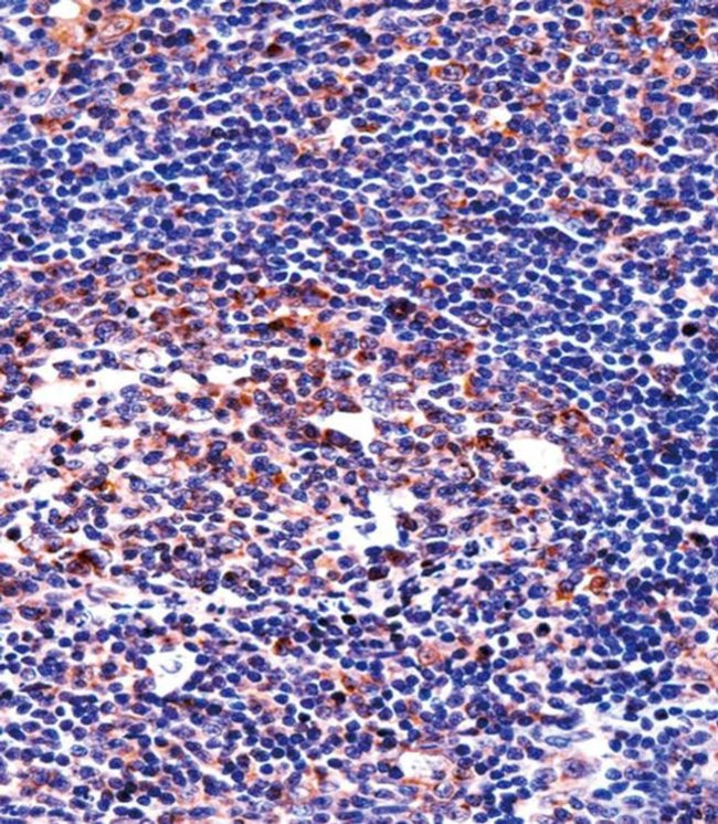 QPRT Antibody in Immunohistochemistry (Paraffin) (IHC (P))