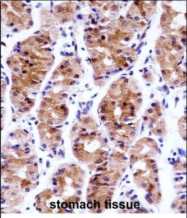 GTF2E1 Antibody in Immunohistochemistry (Paraffin) (IHC (P))