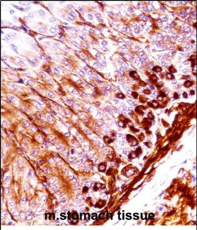NEK5 Antibody in Immunohistochemistry (Paraffin) (IHC (P))