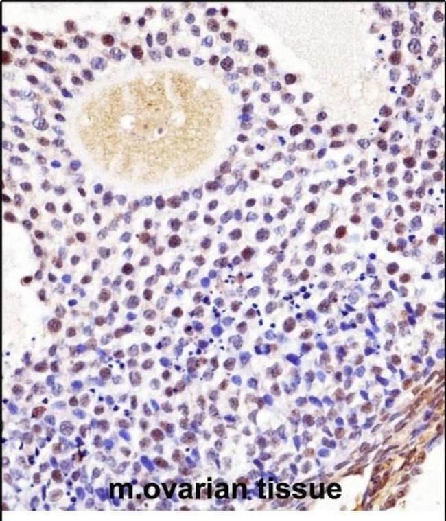 WEE2 Antibody in Immunohistochemistry (Paraffin) (IHC (P))
