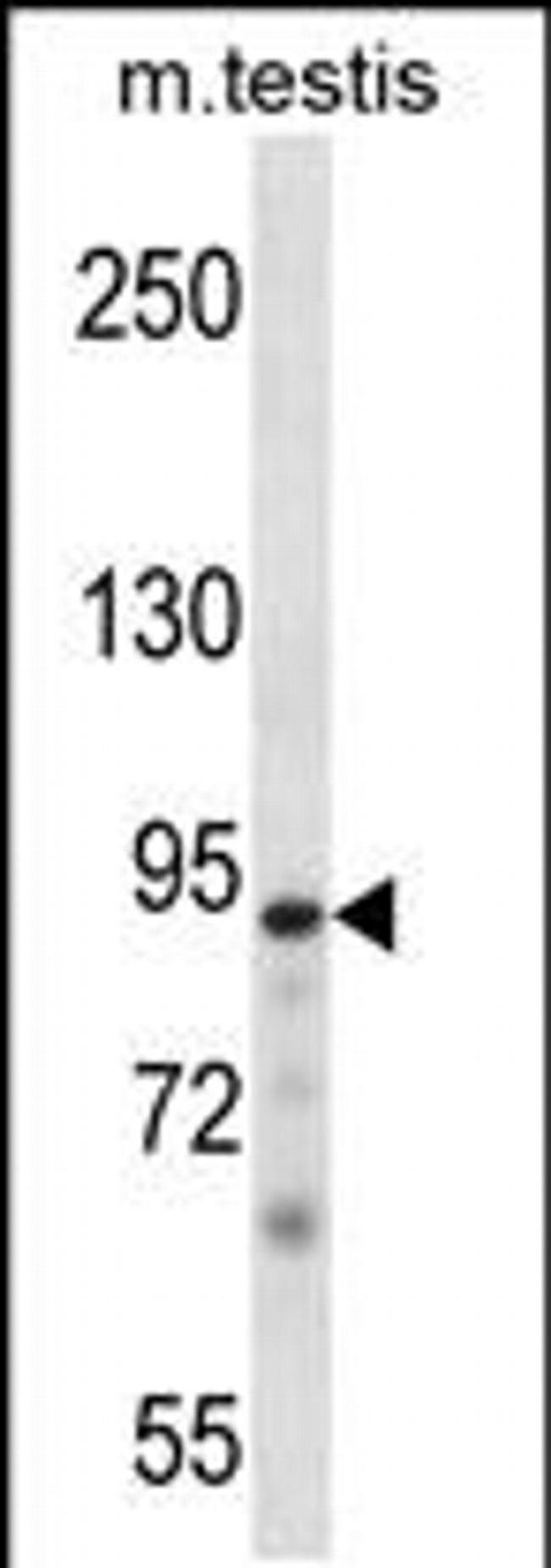PKN3 Antibody in Western Blot (WB)