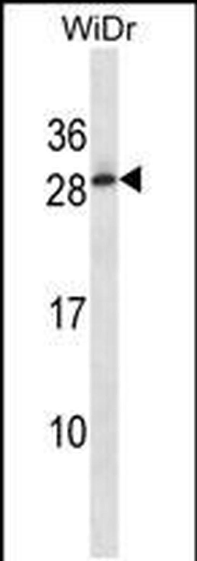 C11orf20 Antibody in Western Blot (WB)