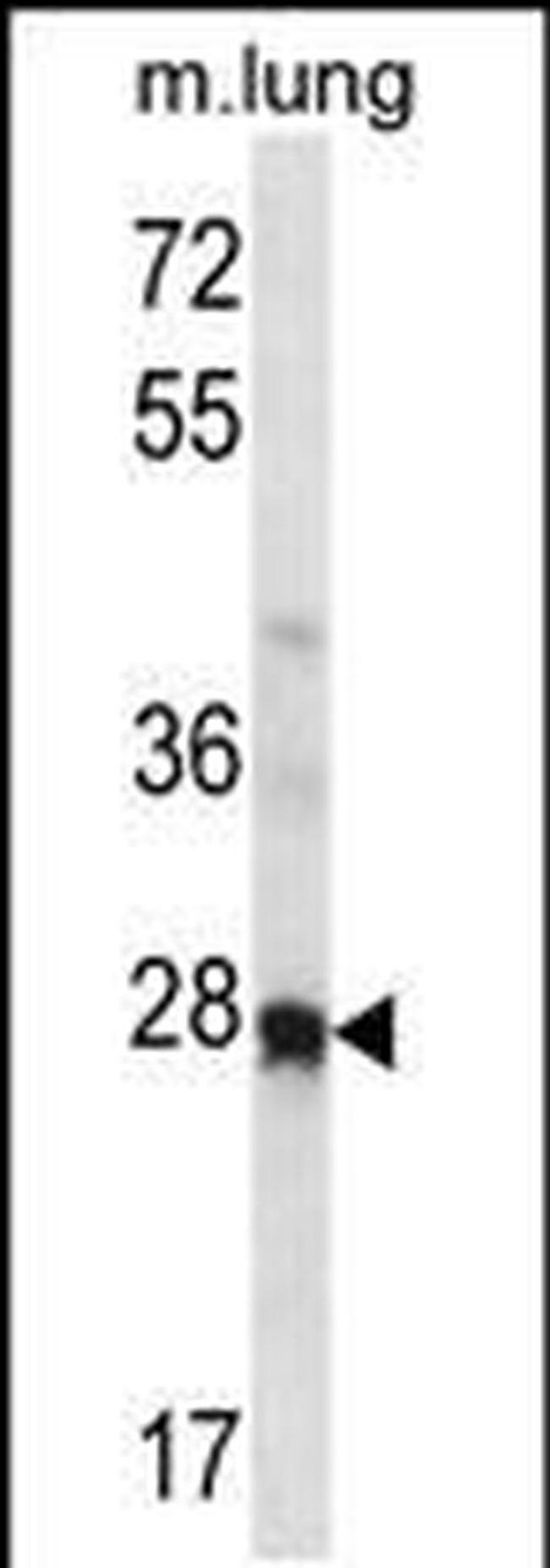 HOXA4 Antibody in Western Blot (WB)