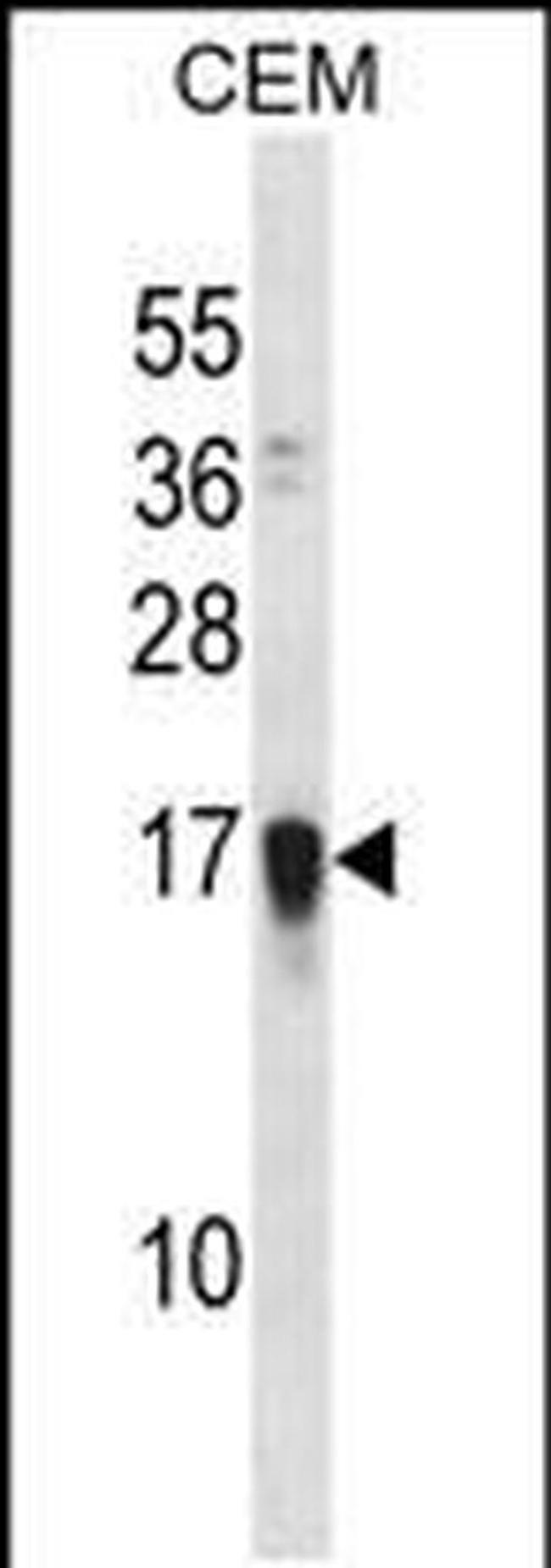 FAM163A Antibody in Western Blot (WB)
